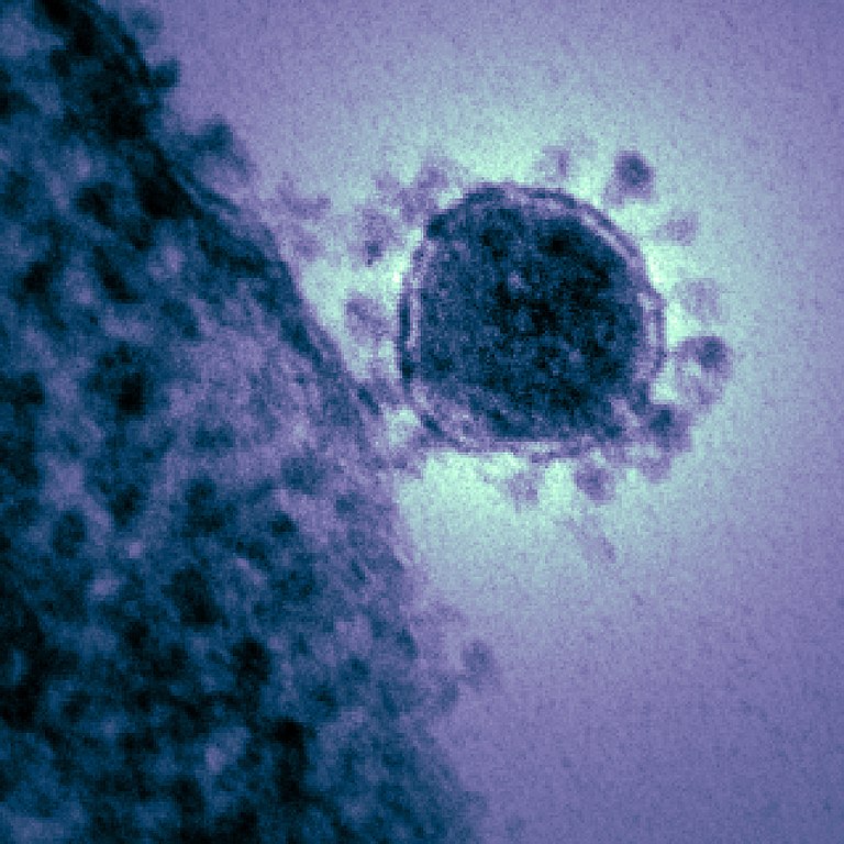 Coronavirus greift auch das Immunsystem an [Video]