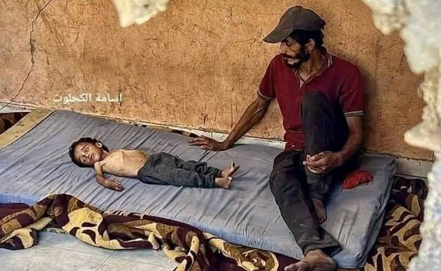 Die Wahrheit hinter dem Foto: Was wirklich mit Abdul in Gaza geschah