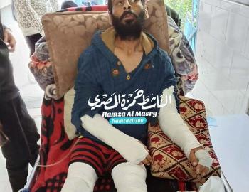 Gebrochene Knochen, gebrochene Stimmen – so sieht Hamas-Herrschaft in Gaza aus